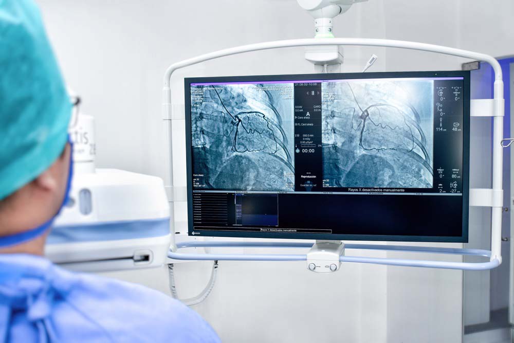 Fisiologia-cardiologica-HA-ClinicaLondres